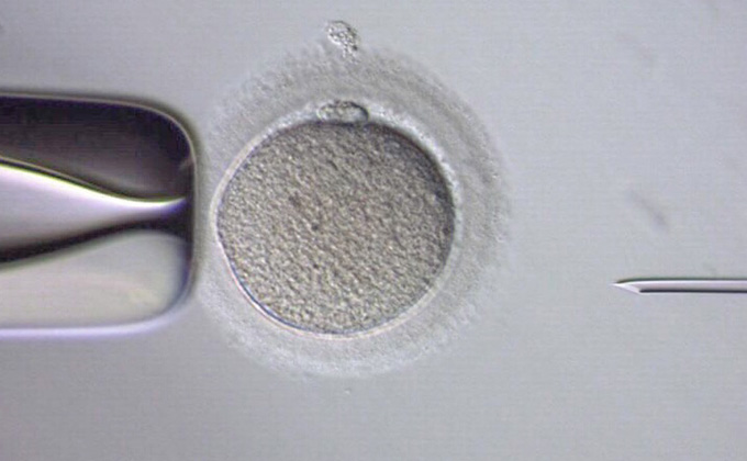 Intracytoplasmic Sperm Injection (ICSI) - Chularat IVF / Chularat 11 International Hospital