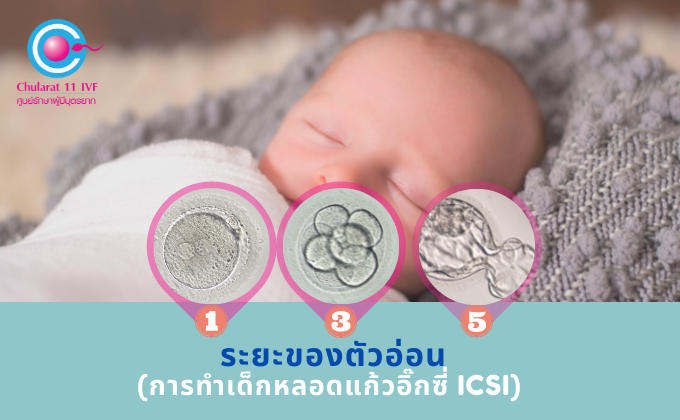 ควรย้ายตัวอ่อนระยะใดดี ระหว่างตัวอ่อน DAY 3 หรือ DAY 5 บลาสโตซีสต์ - Chularat IVF / Chularat 11 International Hospital