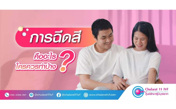ท่อนำไข่ตีบตันเป็นอีกสาเหตุหนึ่งของภาวะมีบุตรยาก - ศูนย์รักษาผู้มีบุตรยาก โรงพยาบาลจุฬารัตน์ 11 อินเตอร์